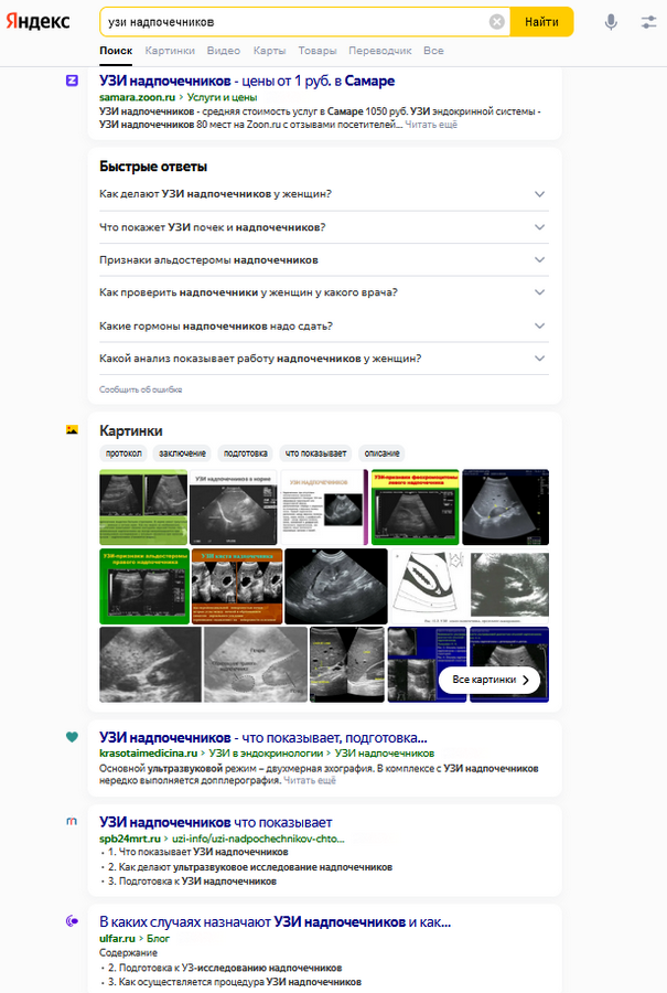 /users_files/wintramedia/Узи надпочечников.PNG